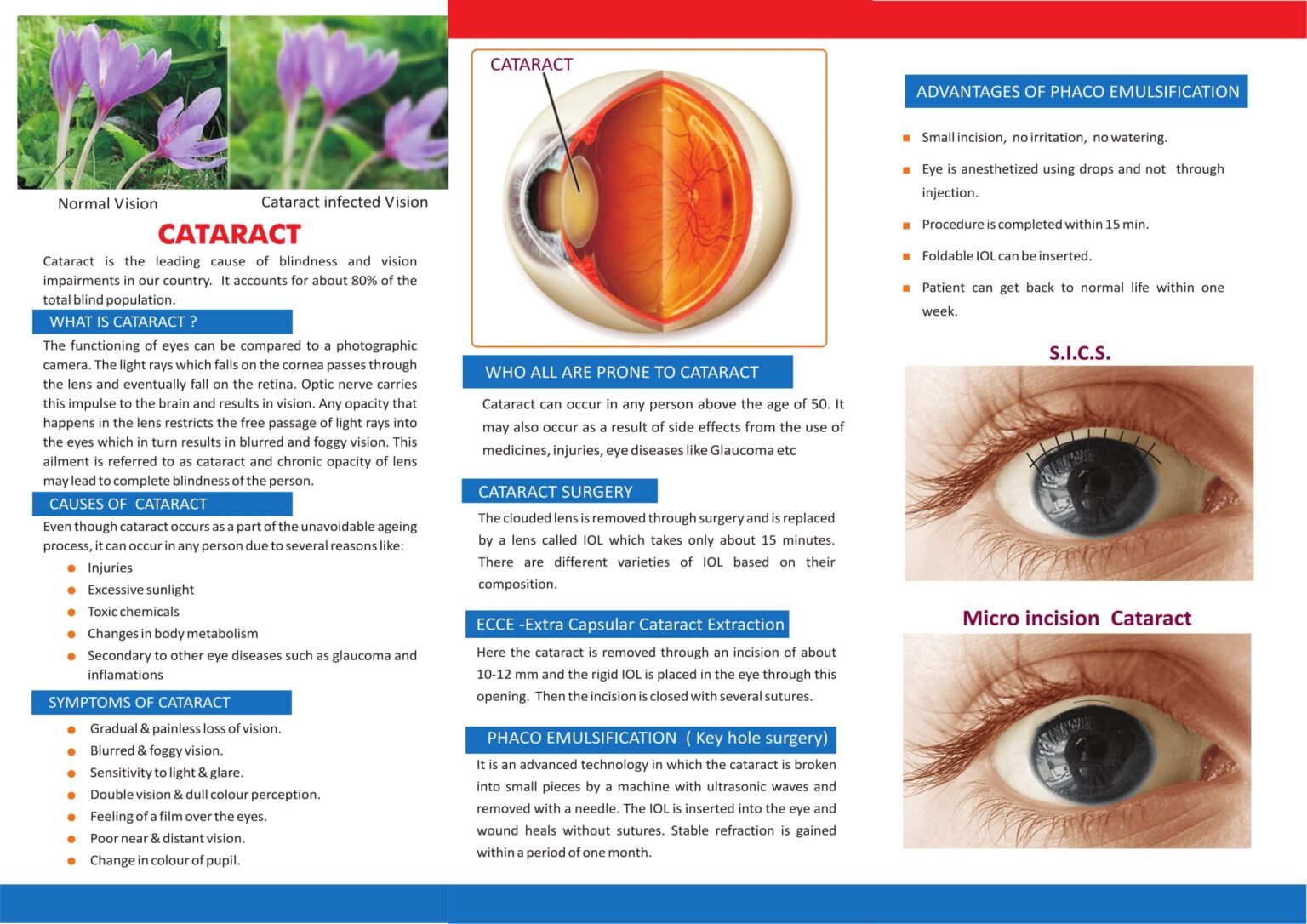 Cataract - Ahalia Foundation Eye Hospital